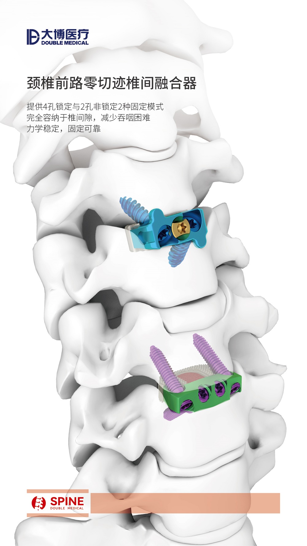 9-颈椎前路零切迹椎间融合器.jpg